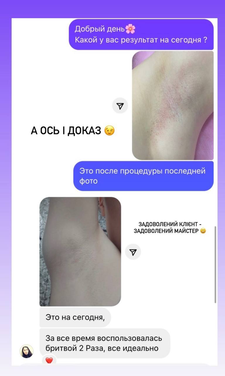 Відгук 1